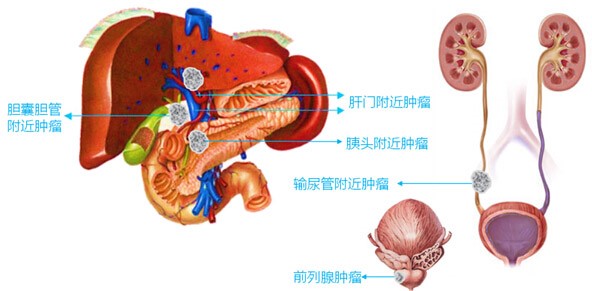 fuda04_832113.jpg 4nano.jpg