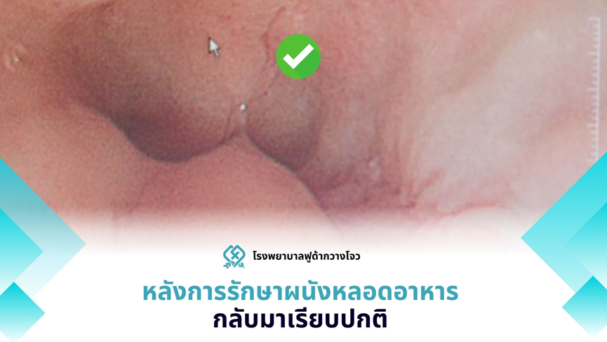 ny03_974524.png image.png