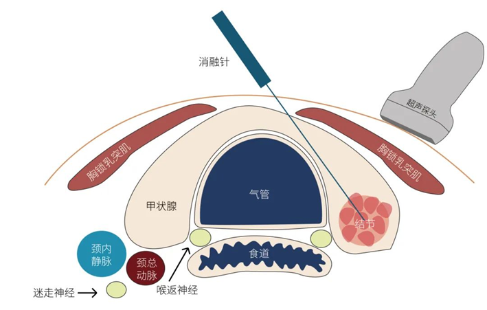 ny30_534560.png image.png