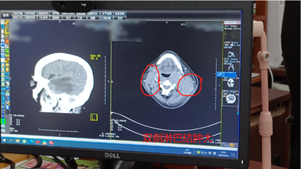ny26_846313.png image.png
