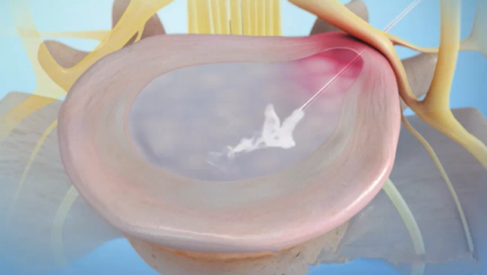 ny08_680287.png image.png