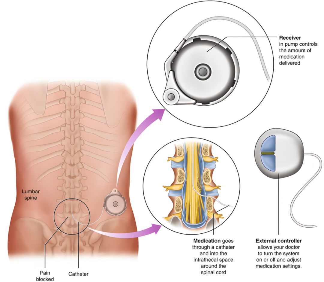 ny13_787226.jpg 2.jpg